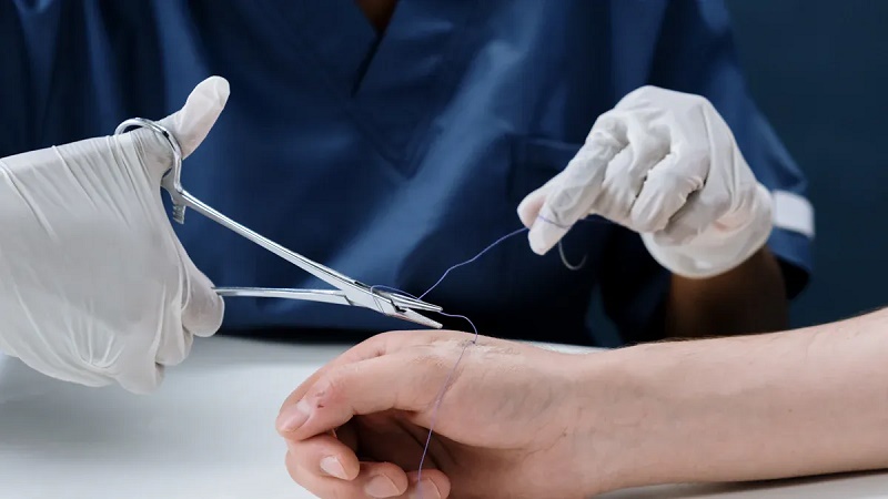 Для чего используется шовный проводник?