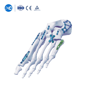 Система стопорных пластин для стопы и лодыжки